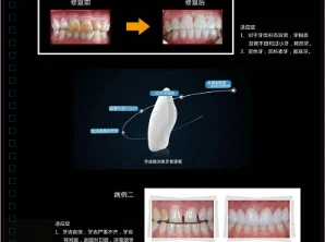 Case medical case of illness